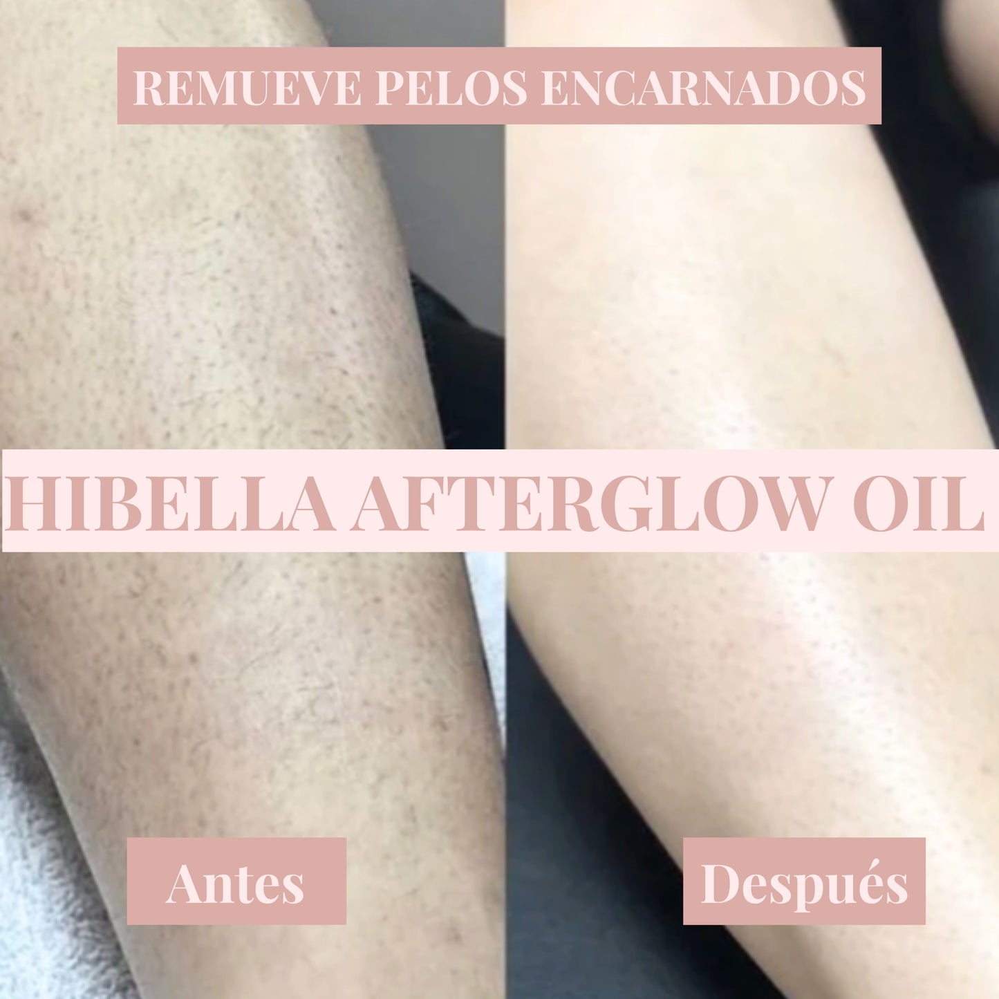 HIBELLA - AFTERGLOW OIL